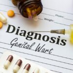 Genital Warts: Causes, Symptoms, Diagnosis & Treatment