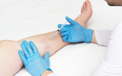 what kind of doctor treats varicose veins