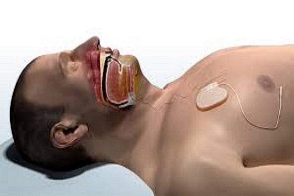 sleep apnea dentistry near me
