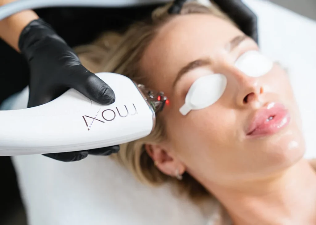 BBL and Moxi Laser: Which is best for skin treatment?