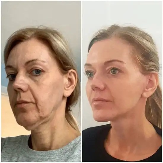 Best Aesthetic Clinics in dubai